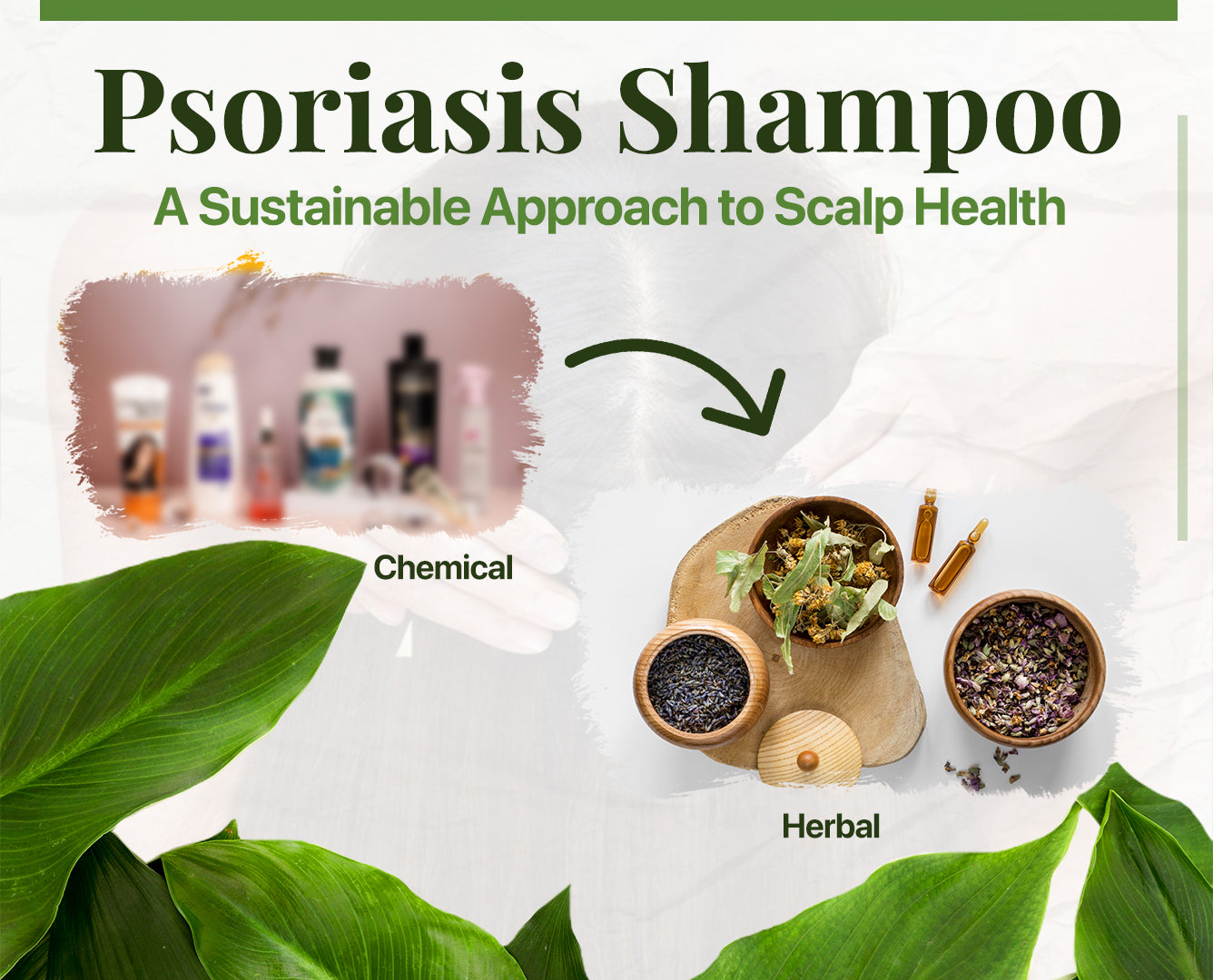 Psoriasis Shampoo: A Sustainable Approach to Scalp Health