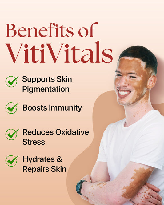Vitivitals Tablets | Vitiligo Treatment Solution