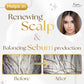 Scalp Exfoliating Serum (Anti-Dandruff Serum)