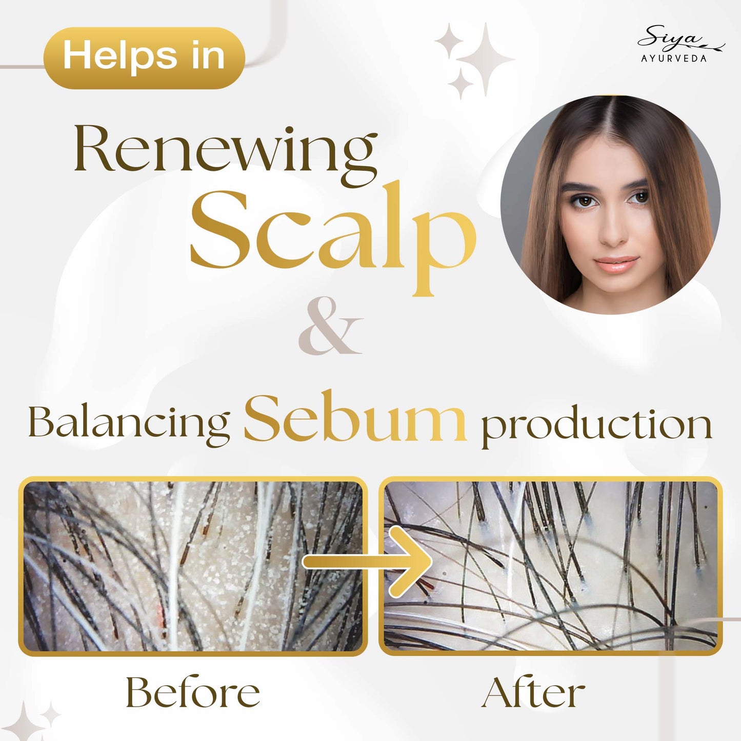 Scalp Exfoliating Serum (Anti-Dandruff Serum)
