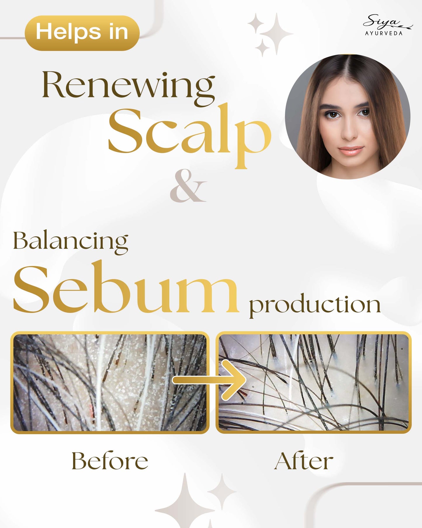 Scalp Exfoliating Serum (Anti-Dandruff Serum)