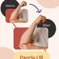 Psoria Oil: Oil for Scalp and Full Body Psoriasis