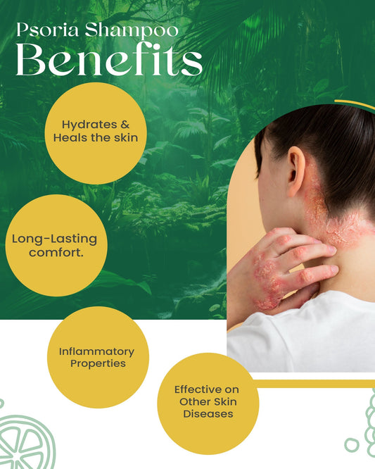 Psoriasis Shampoo: Siya Ayurveda Psoria Shampoo